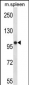 POLR3B Antibody (N-term)